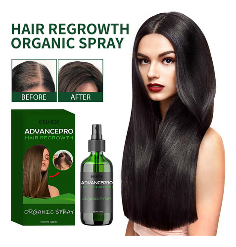 Spray Para El Crecimiento Del Cabello, Nutritivo, Rellenador