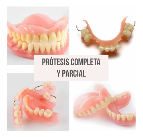 Imagen 1 de 5 de Prótesis Dental, Prótesis Fija