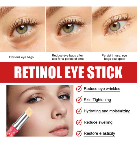 Z Retinol Eye Cream Deeply Moisturizes Tightens And Lif 8006