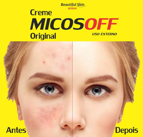 Creme Para Micose Manchas Na Pele Melasma Acne Micosoff 60g Baunilha