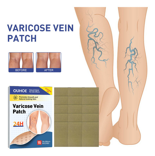/ R Parche Para Venas Varicosas Parche Para Venas Varicosas