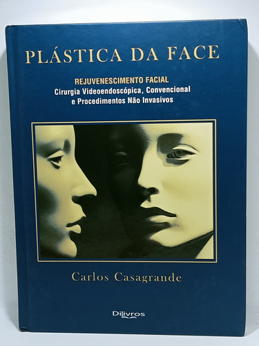 Cara De Plastico - En Portugues - Cirugia Estetica - 2018
