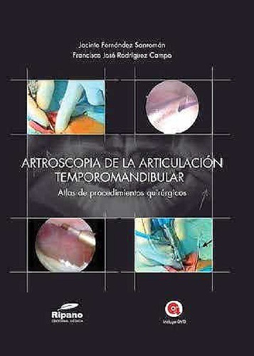 Artroscopia De La Articulacion Temporomandibular, De Sanroman. Editorial Ripano En Español