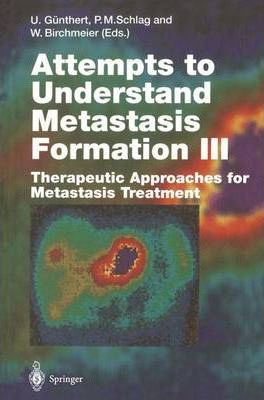 Libro Attempts To Understand Metastasis Formation Iii : T...