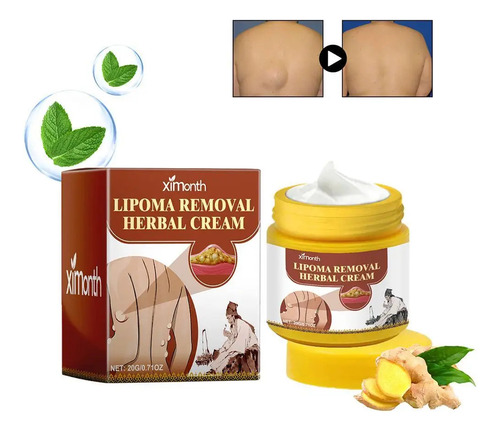 Crema Para Eliminar Bultos Subcutáneos Lipoma Cream, 20 G