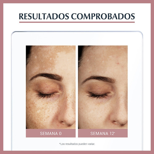 Imagen 7 de 10 de Serum Facial Dual Antimanchas Eucerin Anti Pigment 30ml
