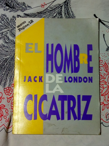 El Hombre De La Cicatriz - Zona Vte. Lopez