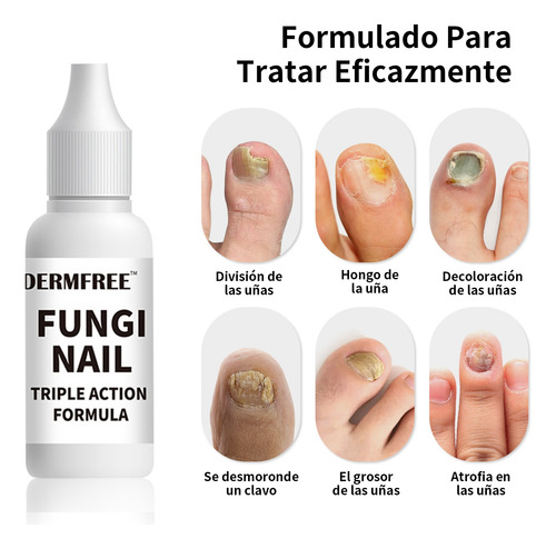 Hongo En Uñas Solución - Tratamiento De Uñas Grises 1pcs