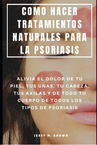 Libro: Como Hacer Tratamientos Naturales Para La Psoriasis: