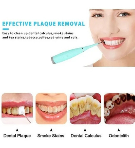 Removedor Dental Ultrasonico Portátil Usb Cálculos