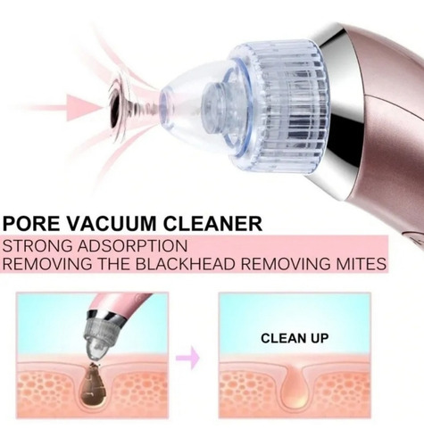 Removedor Extractor Puntos Negros Espinillas Limpieza Facial