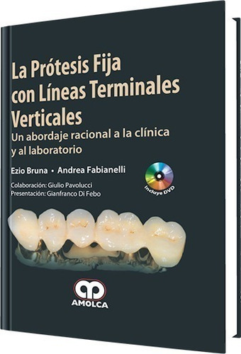 La Prótesis Fija Con Líneas Terminales Verticales. Clín. Lab
