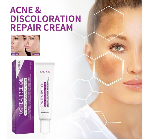 Crema X Azelaic, 10% Azelaic Booster Healing, Para Rostro Y