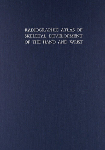 Radiographic Atlas Of Skeletal Development Of The Hand An...