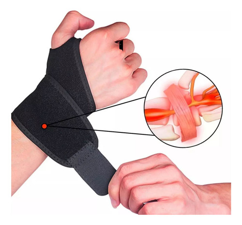 Munhequeira Tensor De Pulso Tendinite Anatomica Ajustavel