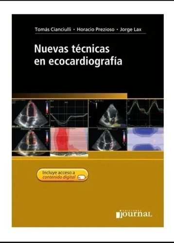 Nuevas Técnicas En Ecocardiografía 