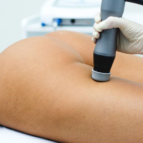 Thork Aparelho De Ondas De Choque Com 1 Aplicador - Ibramed
