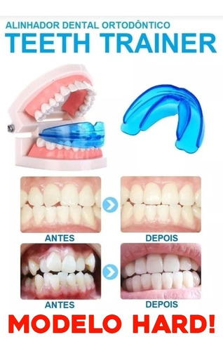 Aparelho Silicone P/ Alinhamento Dos Dentes * Modelo Hard *