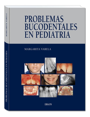 Odontología Problemas Bucodentales En Pediatría Ergon