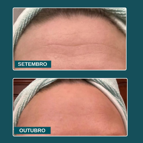 Kit Lucence Para Pele E Orelhas Uniformiza Hidrata Restaura Todo Tipo De Pele Dia/noite