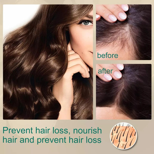 1 Crema Para El Crecimiento Del Cabello Con Aceite De Jengib