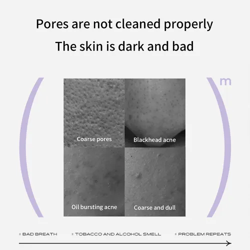 Mascarilla Limpiadora De Poros Para Hombres Y Mujeres, Tipo