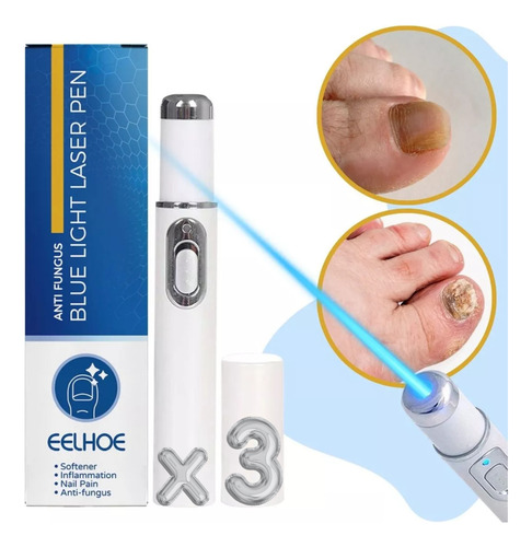 3 Pluma Luz Azul Elimina Hongo Cuidado Uñas Reparación Láser