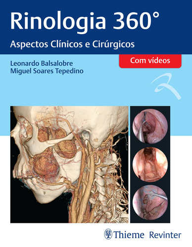 Rinologia 360°: Aspectos Clínicos e Cirúrgicos, de Balsalobre, Leonardo. Editora Thieme Revinter Publicações Ltda, capa dura em português, 2021