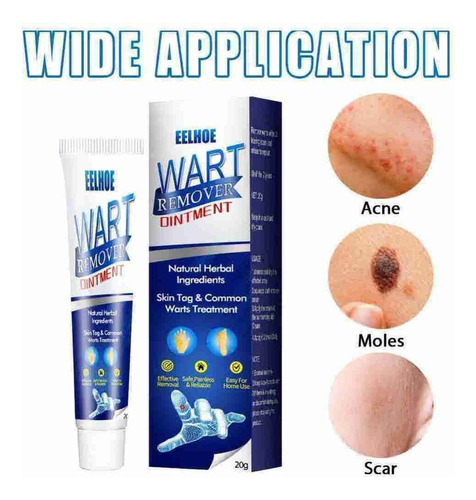 Cuidados De Limpeza Da Pele Para Remover Calos, Verrugas E V
