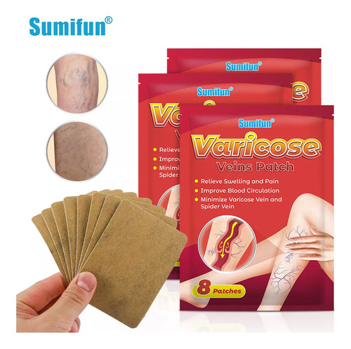 3×parche Para Varices, Promueve La Circulación Sanguínea