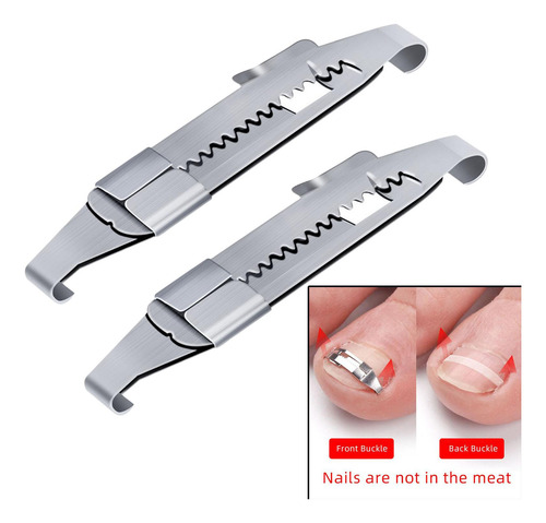 2 Uds Herramientas De Corrección De Uñas Encarnadas Clips