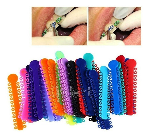 Ligaduras Ortodoncia Elásticos Multicolores Las Más Lindas