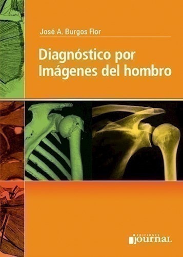 Diagnóstico Por Imágenes Del Hombro - Burgos Flor, José A.