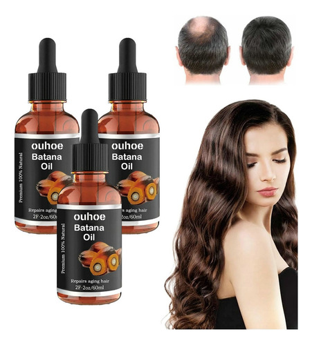 , Aceite For El Crecimiento Del Cabello, 3 Unidades, 60 Ml A
