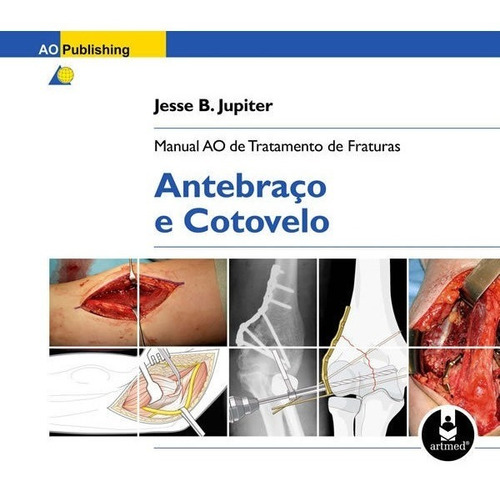 Manual Ao De Tratamento De Fraturas Antebraço E Cotovelo