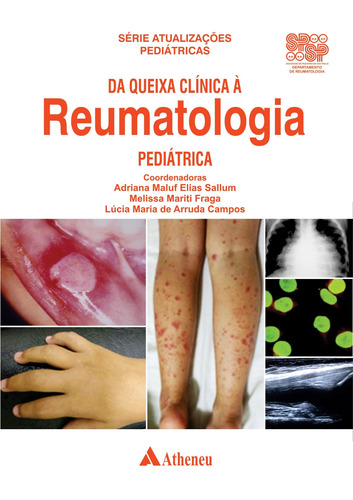 Da Queixa Clínica à Reumatologia Pediátrica, de Sallum, Adriana Maluf Elias. Editora Atheneu Ltda, capa dura em português, 2019