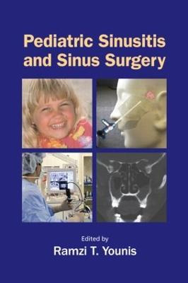 Libro Pediatric Sinusitis And Sinus Surgery - Ramzi T. Yo...