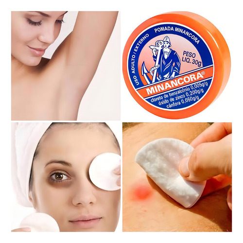 Acnezil Gel 20g Trata Cravos E Espinhas + Pomada Minancora