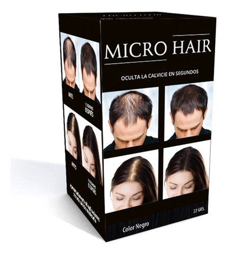 Micro Hair - Para Ocultar Calvicie Y Alopecia: 3 Colores 