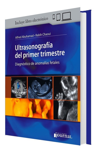 Abuhamad Chaoui Anomalías Fetales Ultrasonografía 1er Trimes