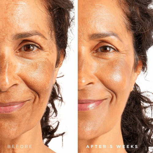 Tree Of Life - Suero De Niacinamida Refinante (vitamina B3)