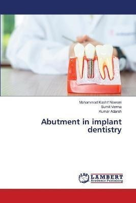 Abutment In Implant Dentistry - Mohammad Kashif Noorani