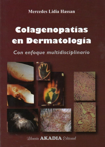 Colagenopatia En Dermatologia Con Enfoque Multidisciplinario