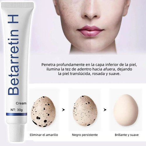 La Crema Para Manchas Oscuras, Crema Betarretin H