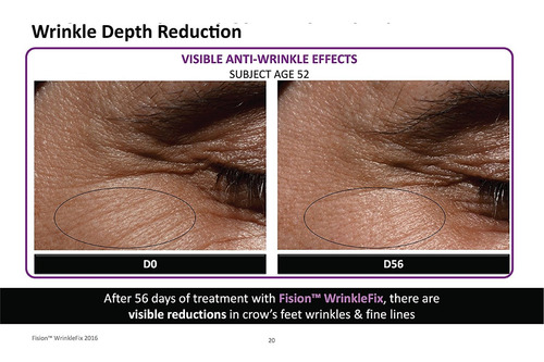 Imagen 3 de 5 de Retinol + Completo Anti-aging Crema Hidratante Facial Con Ác