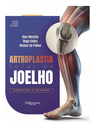 Livro: Artroplastia Total Do Joelho - Conceitos E Técnicas - Contem Acesso A Vídeos - Alan Mozella, Hugo Cobra E Idemar De Palma