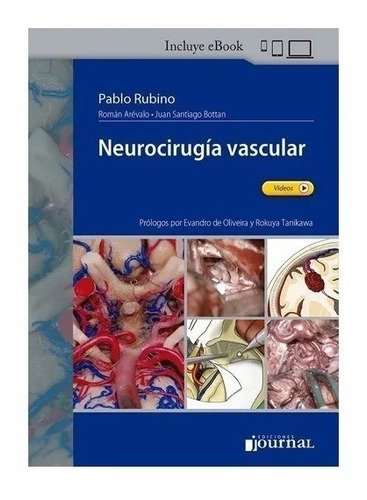 Rubino Neurocirugía Vascular Nuevo!