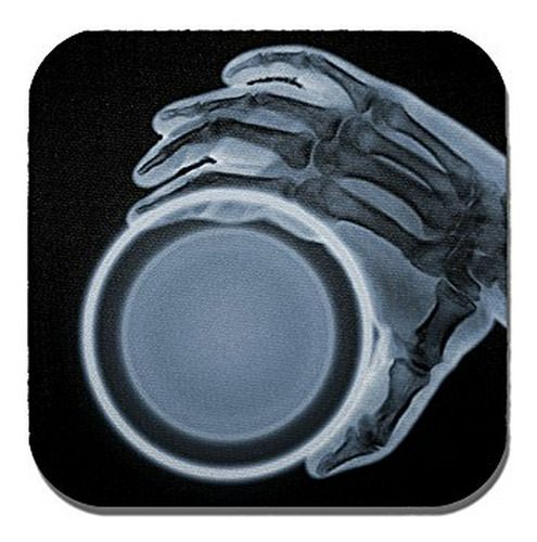 Posavasos De Imagen De Rayos X - Radiografía De Una Mano Sos