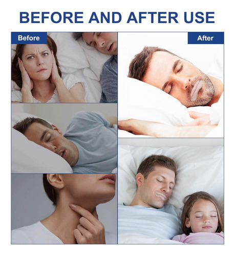 Tiras Para Dormir Para Roncar Cinta Para Dormir Boca Respira