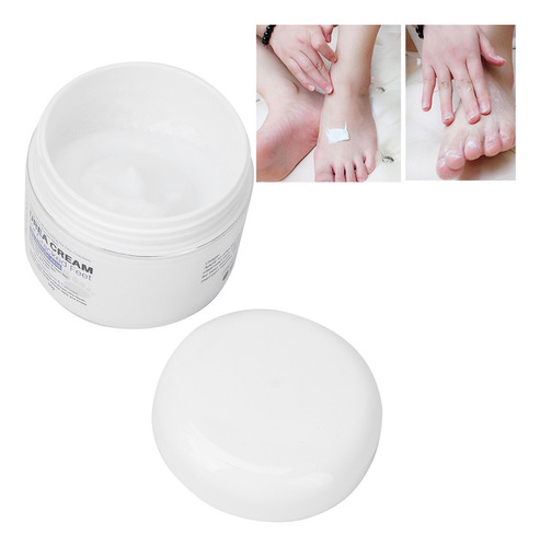 Crema De Urea Resequedad Extrema Codos Talones Pies